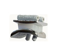 BOX ankle replacement: image from MatOrtho